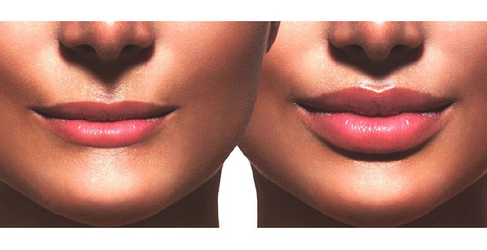 make your lips bigger than now