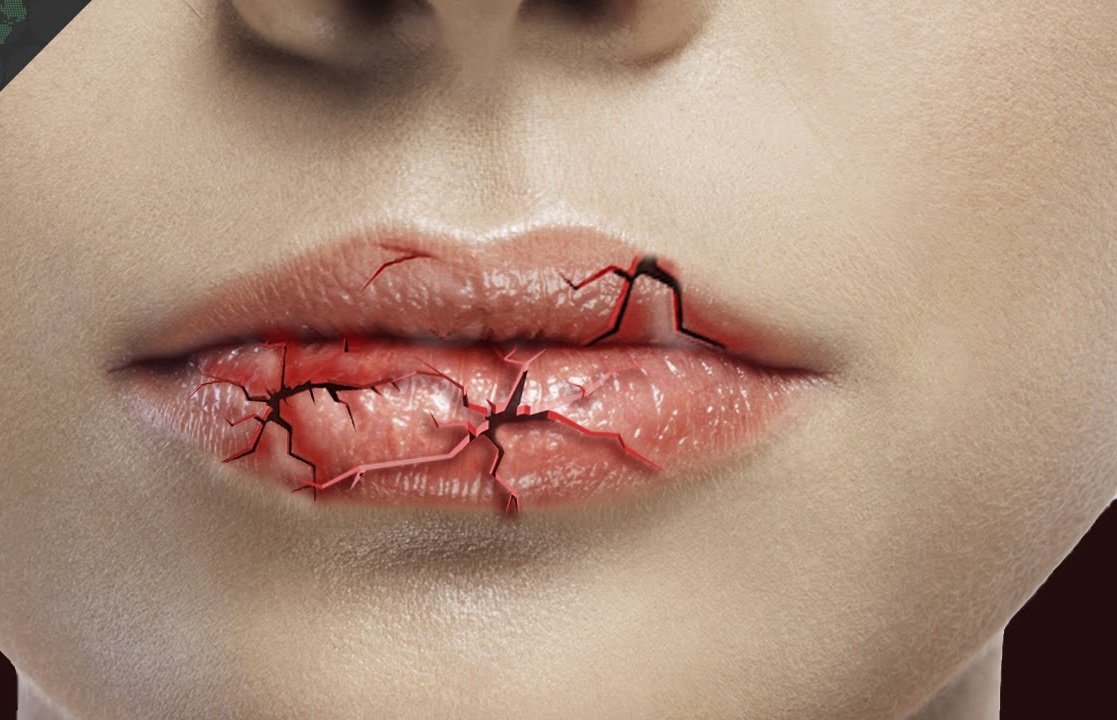 chapped lips photoshop